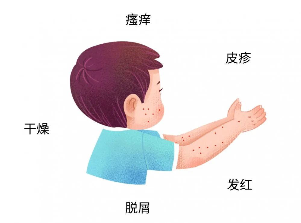 這些癥狀都可能是寶寶過敏傳遞的信號(hào)，很多寶媽還不知道